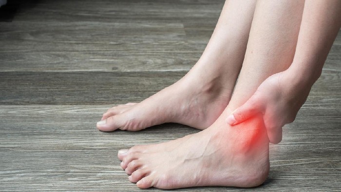 Asam Urat (Gout Arthritis)