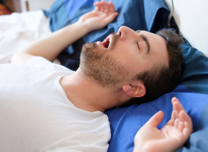 Obstructive Sleep Apnea (OSA)