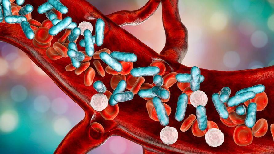 Sepsis