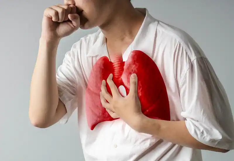 TBC (Tuberkulosis)