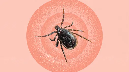 Babesiosis
